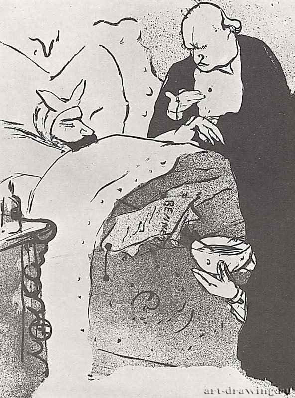 Больной Карно. 1893 - 239 х 175 мм Литография Постимпрессионизм Франция