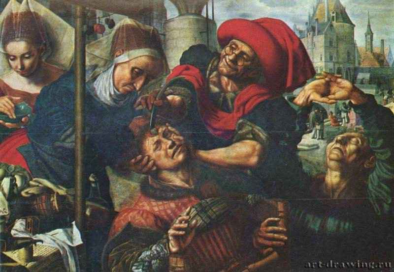 Трепанация черепа. 1554-1550 * - 100 x 141 смДеревоМаньеризмНидерланды (Фландрия)Мадрид. Прадо