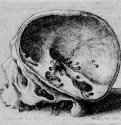 Распиленный человеческий череп. 1651 - 70 х 76 мм. Офорт. Берлин. Гравюрный кабинет. Чехия.